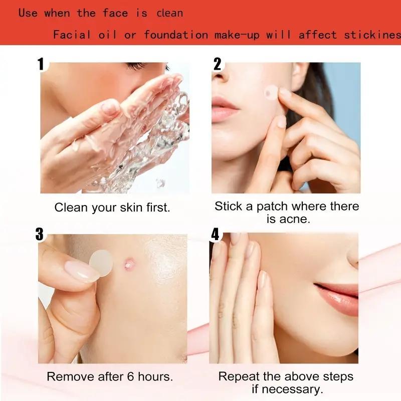 Round Acne Cover Sticker, Invisible Acne Cover Patches, Acne Spot Covering Sticker, Facial Skincare Tools for Daily Use