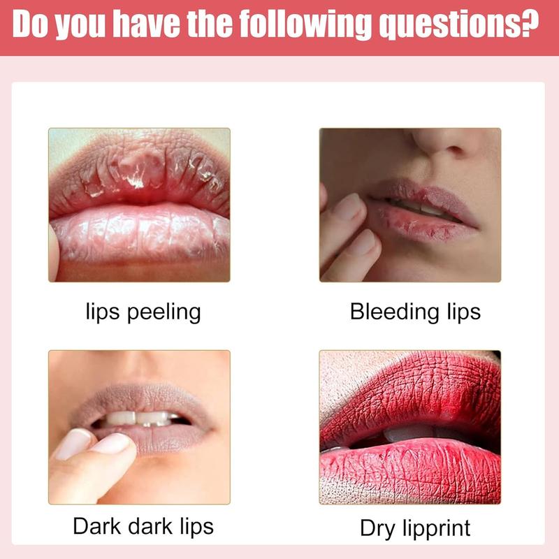 Lips Pink Fresh Fast Lightening Bleaching Cream Balm Treatment Remove Dark Lips Lip Cream Lip Lightening Brightener for Dark Lips to Restore Hydrate Plump Dry Chapped Lips for Smoker (1pc)